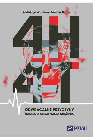 4H i 4T. Odwracalne przyczyny nagłego zatrzymania krążenia