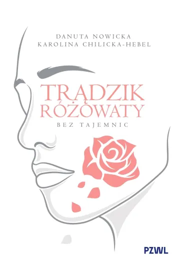 Trądzik różowaty bez tajemnic